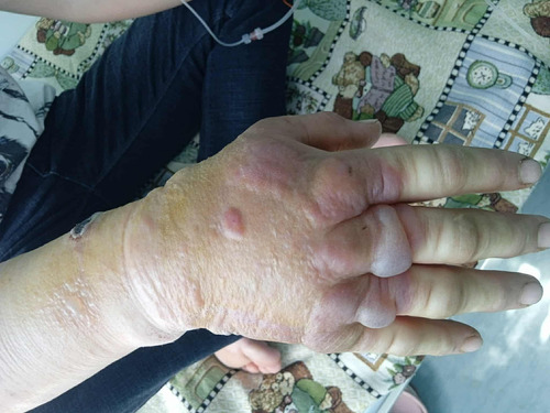 БООМ ӨВЧНИЙ ХҮНИЙ ӨВЧЛӨЛИЙН ТОХИОЛДОЛ БАТЛАГДЛАА